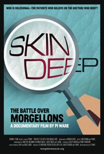 دانلود مستند Skin Deep: The Battle Over Morgellons 2019104233-299307561